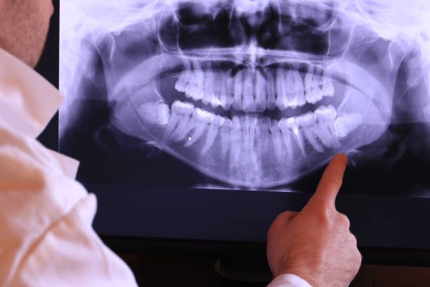 Best Emergency Dental Care for Trauma or Injury in Akron, IN